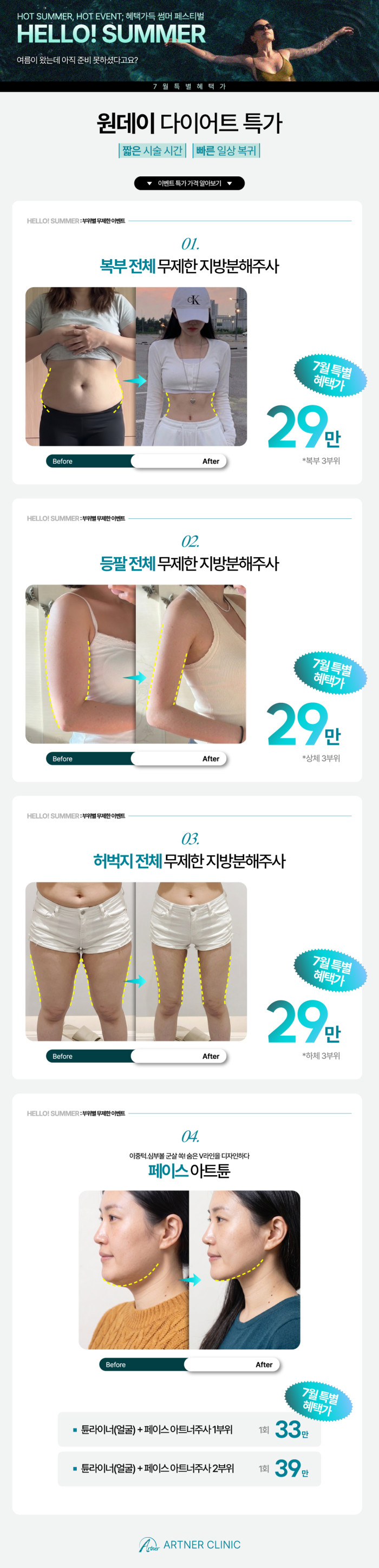 7월 프로모션